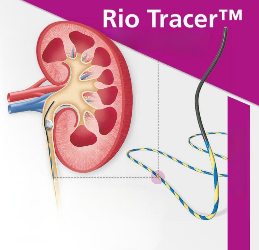 GUIA HIDROFILICA UROLOGIA