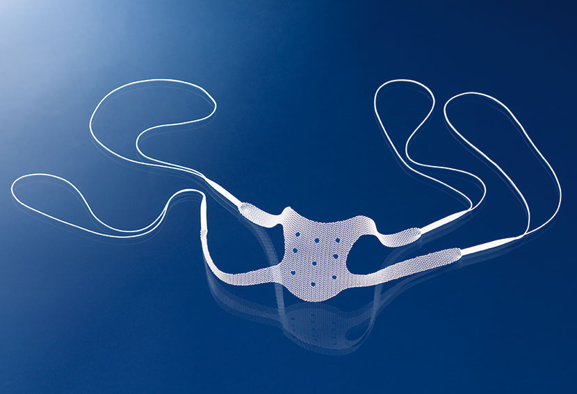 MALLAS PARA REPARACIÓN DE PROLAPSOS